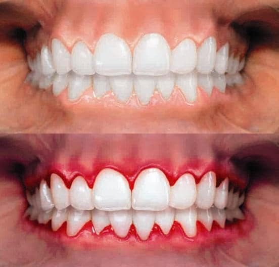 Mujeres sonriendo